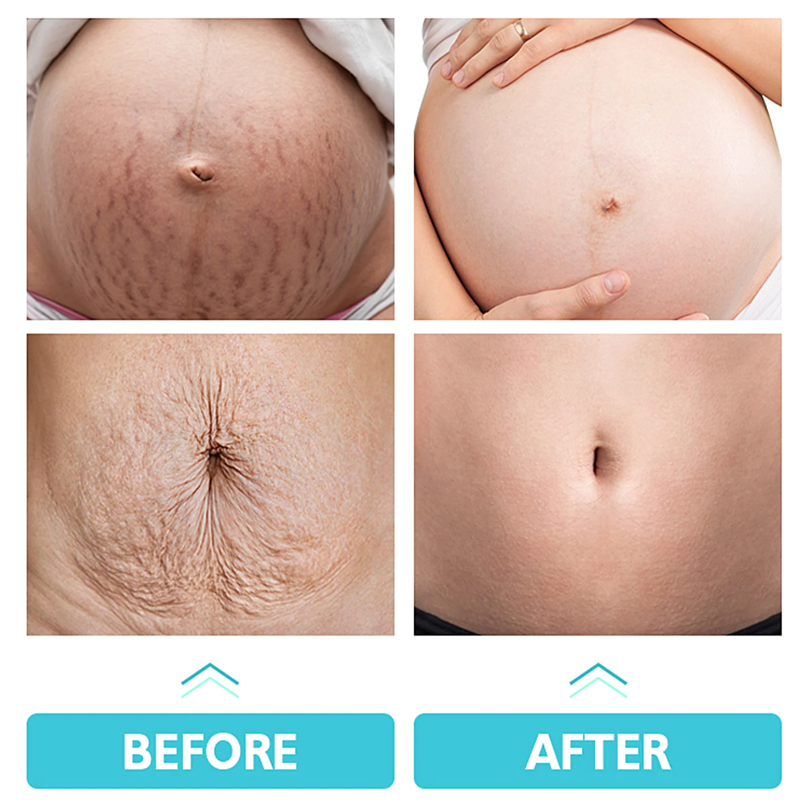 Stretch Mark Repair Cream Deeply Nourishing Moisturizing Enhances Skin Elasticity 60g 9 stretch mark repair cream 60g wii vzp4bab7 desc 9