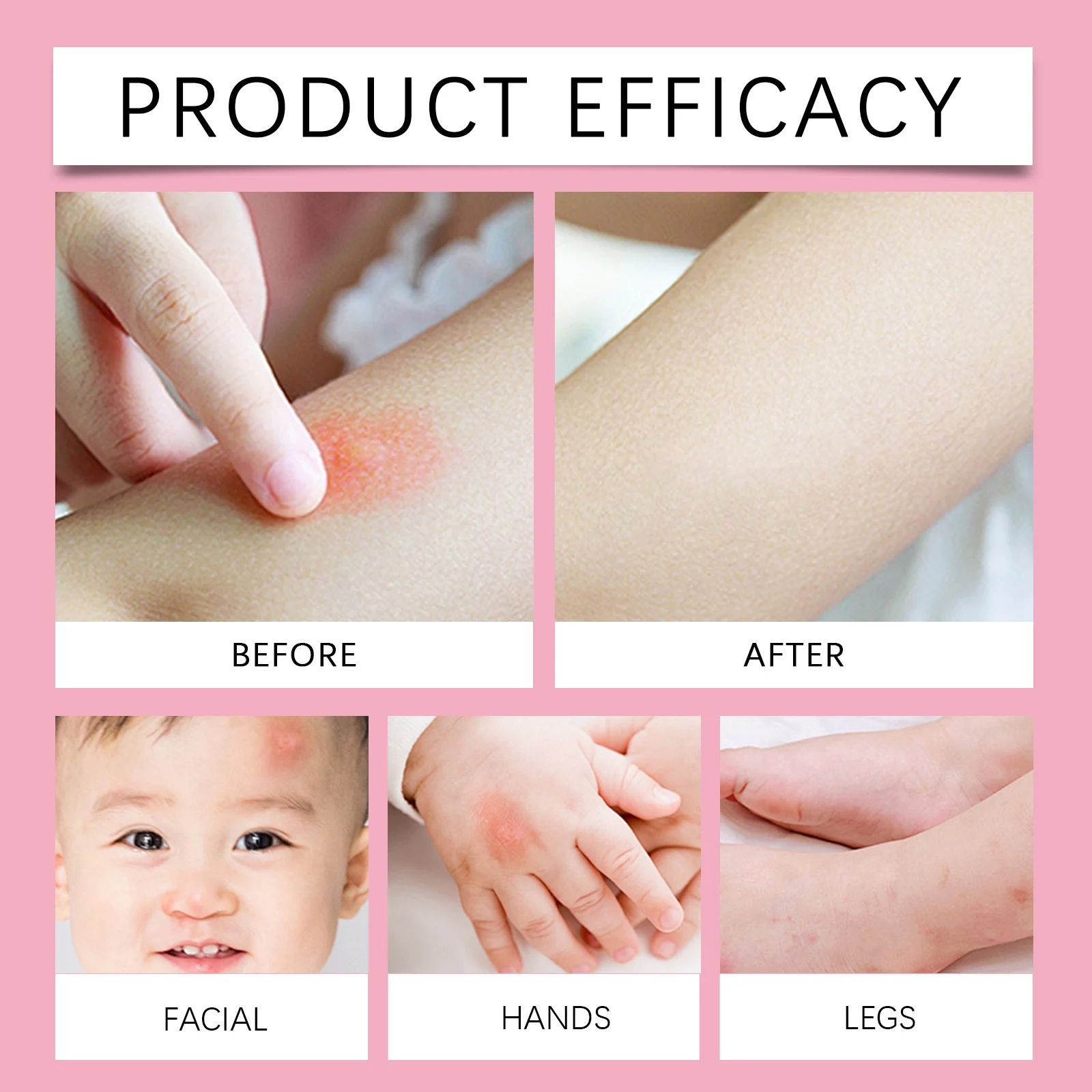 Wiieey Anti-Itch Mosquito Repellent Spray for Pregnant Women & Babies Orange Fragrance 9 wiieey mosquito repellent spray pregnant babies rose scent 80ml wii fyequgej desc 10